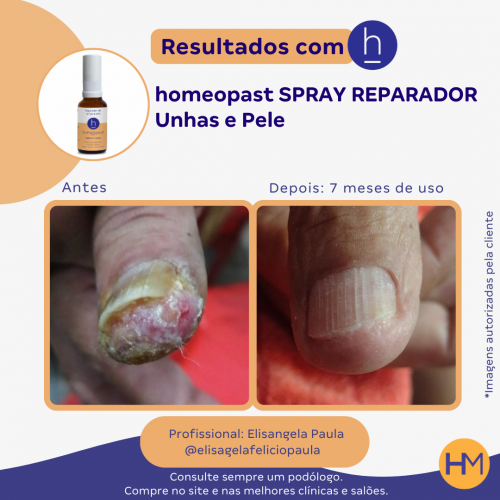 Spray Reparador